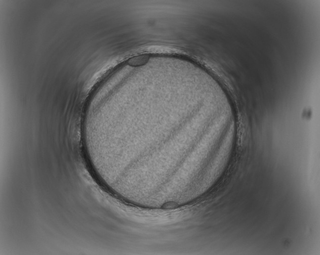 X0000116100015200912141007