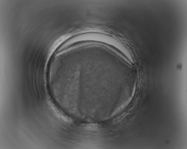 X0000116100104200912141006