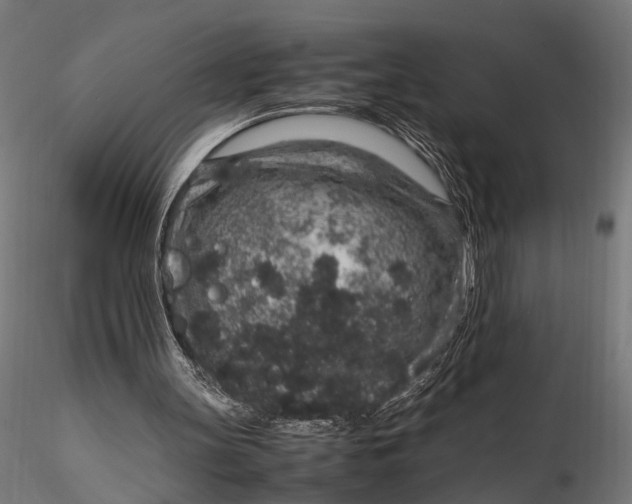 X0000116100147200912141004