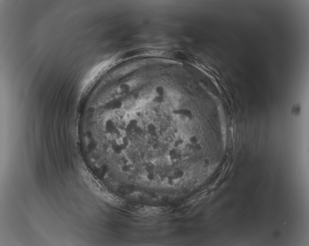 X0000116100149200912141004