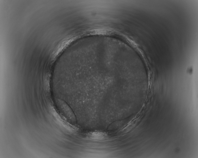 X0000116100154200912141005