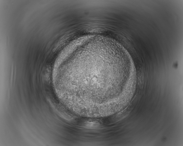 X0000116100175200912141005