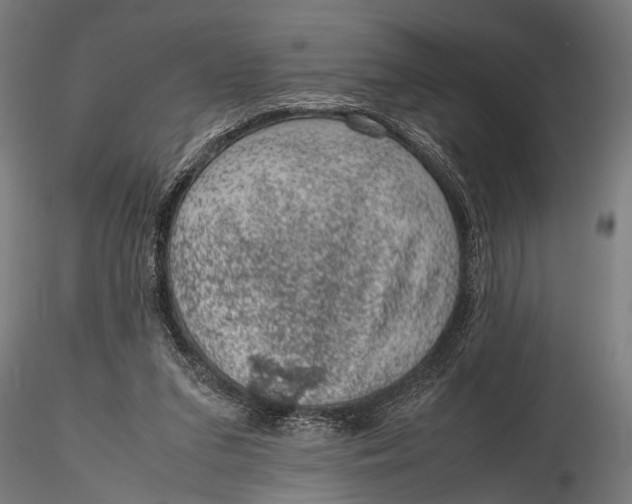 X0000116100207200912141004