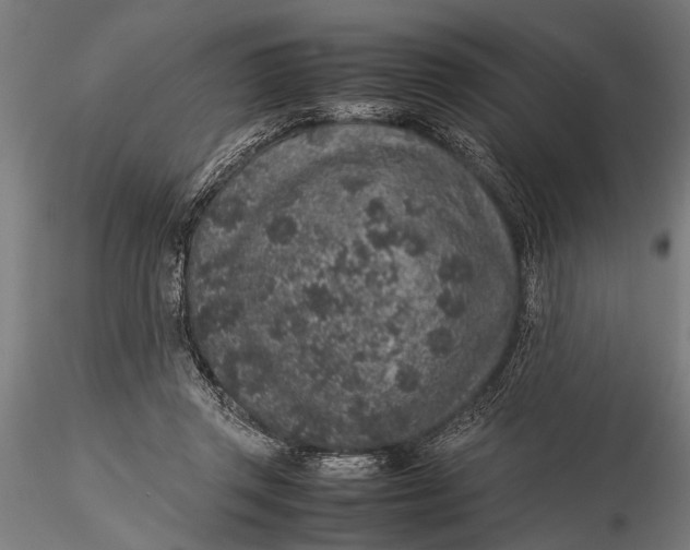 X0000116100357200912141002