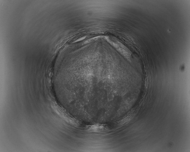 X0000116100366200912141002