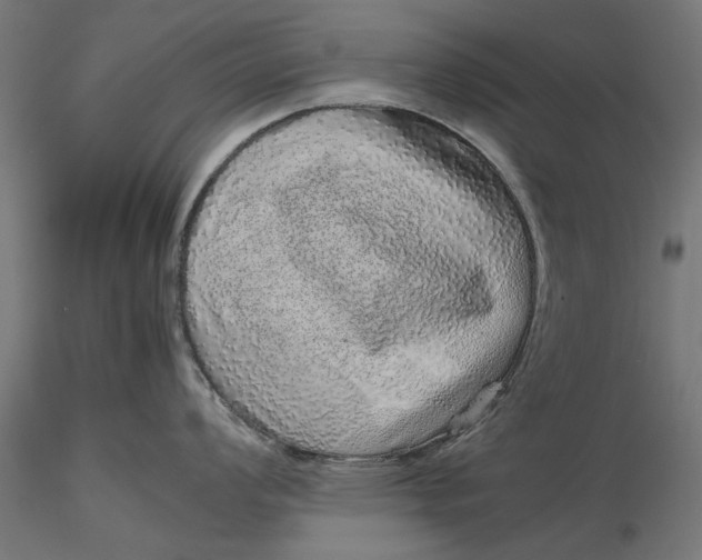 X0000116101008200912140952