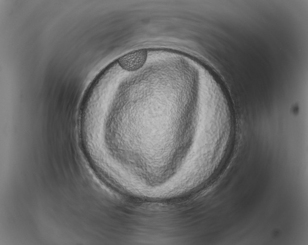 X0000116101517200912140945