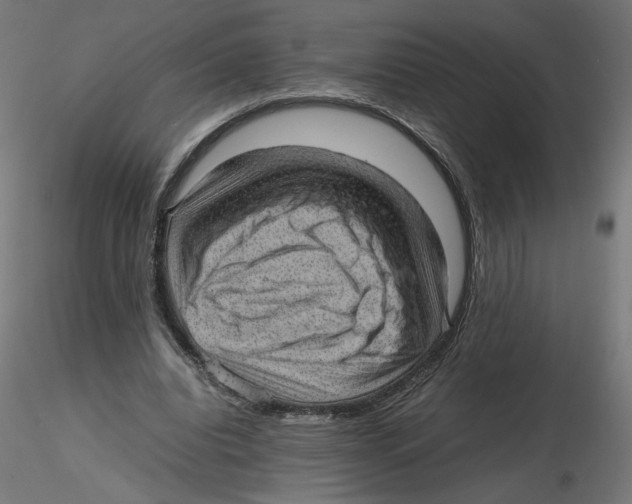 X0000116100440200912211615