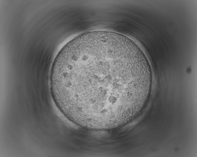 X0000116100957200912211609