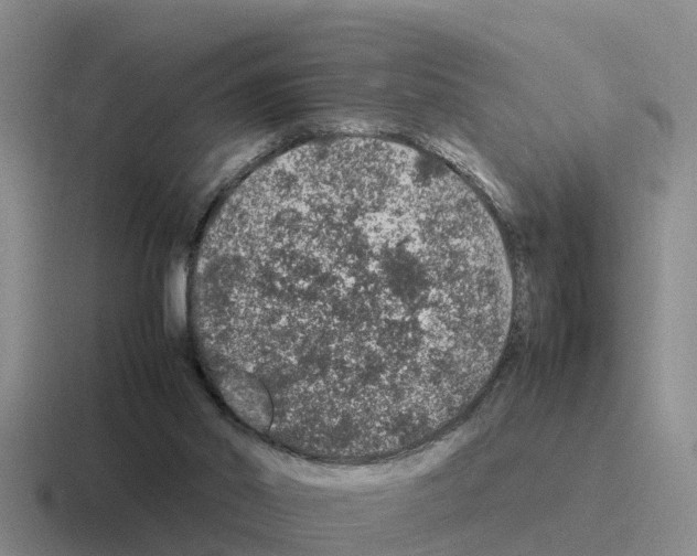 X0000116100014201001041000