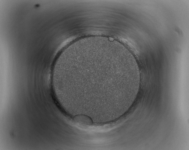 X0000116100016201001041000