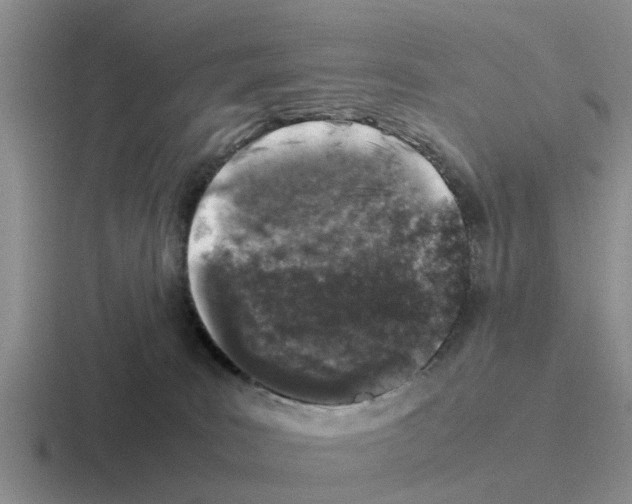 X0000116100035201001041000