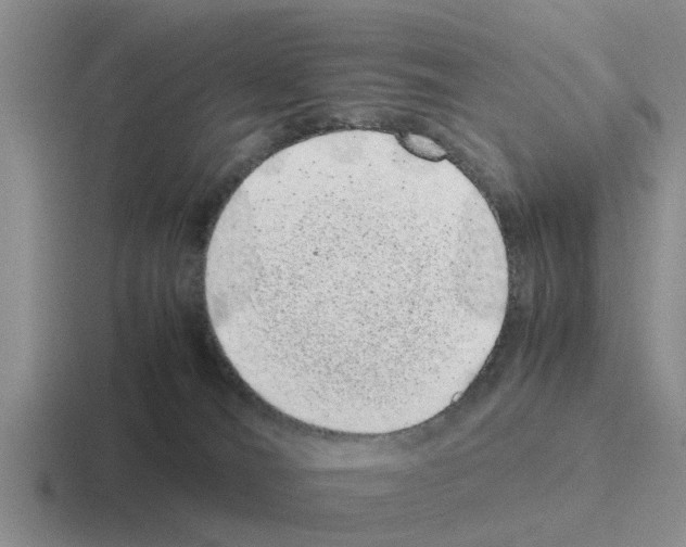 X0000116100036201001041000