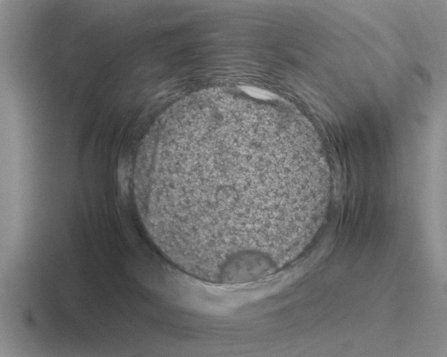 X0000116100038201001041000