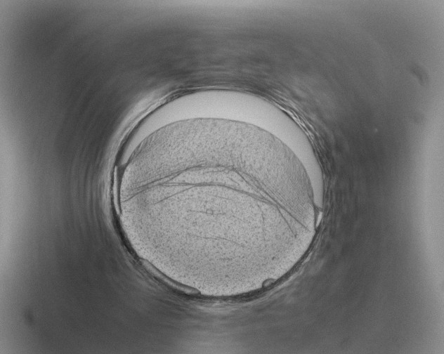 X0000116100293201001040957