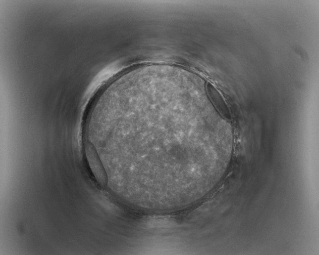 X0000116100296201001040957