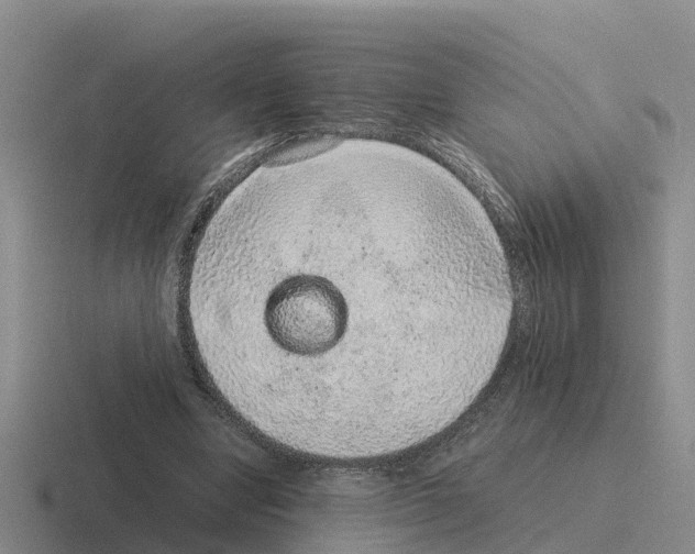 X0000116100442201001040955