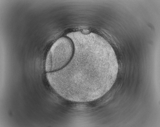 X0000116100462201001040955