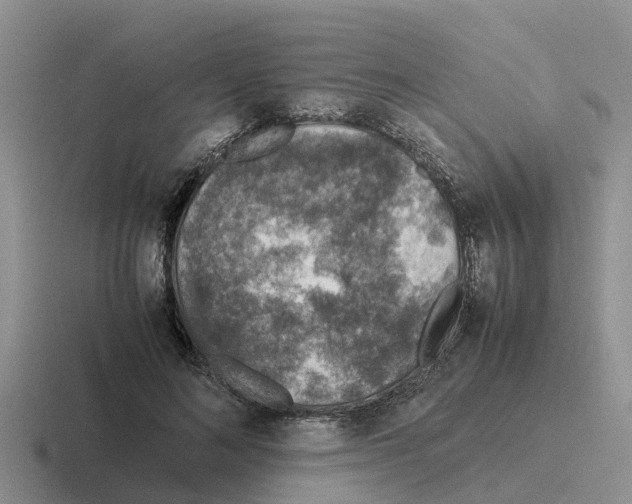 X0000116100692201001040952