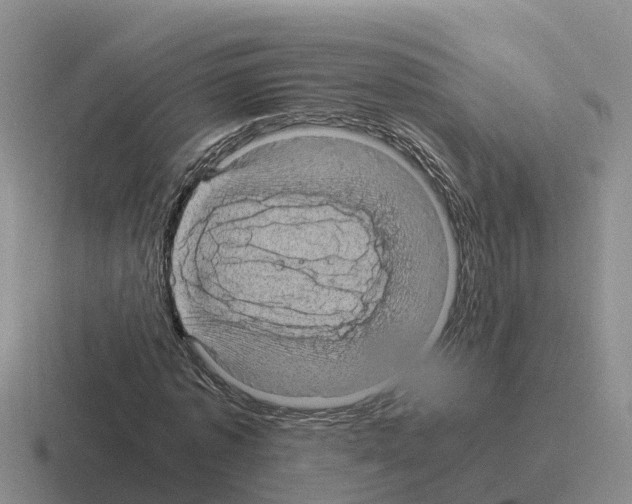 X0000116100773201001040951