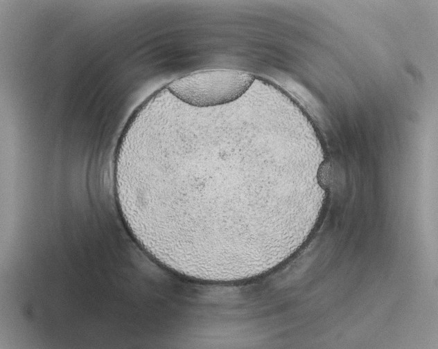 X0000116101238201001040945