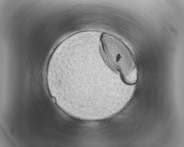 X0000116101525201001040942