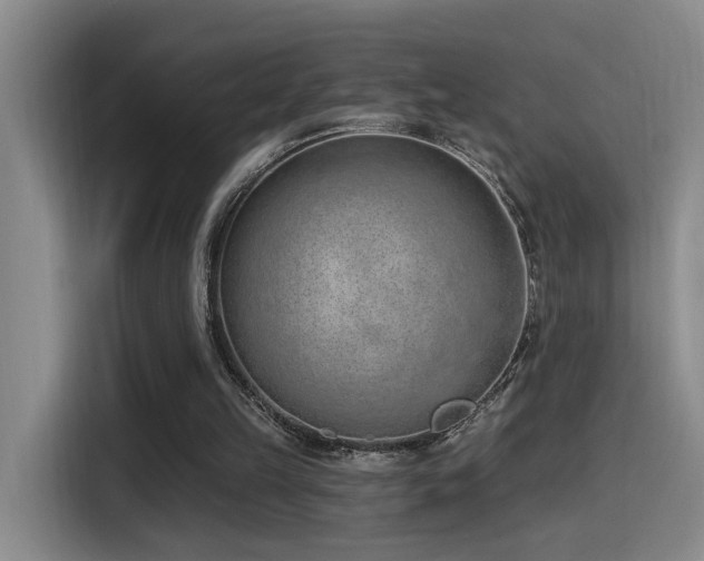 X0000116110149200911231152