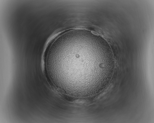 X0000116110294200911231151