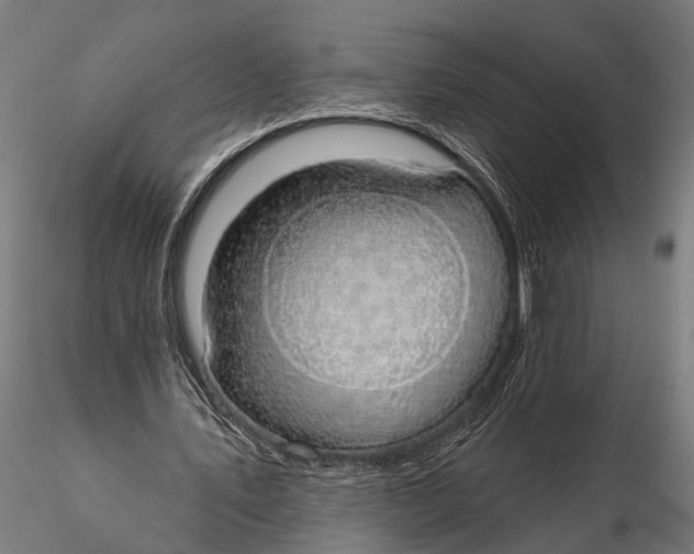 X0000116110579200912141023