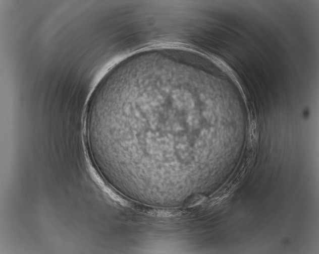 X0000116111005200912141016