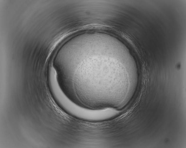 X0000116111075200912141015