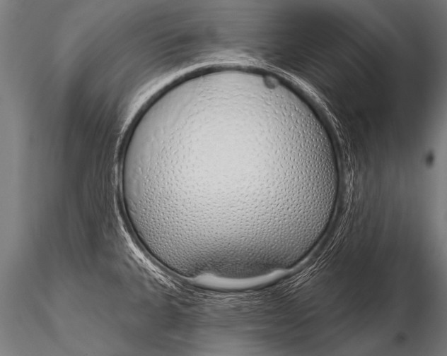 X0000116111335200912141011