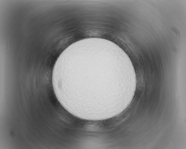X0000116110175201001041018