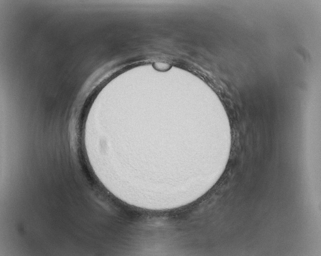 X0000116110247201001041017