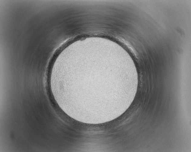 X0000116110399201001041015