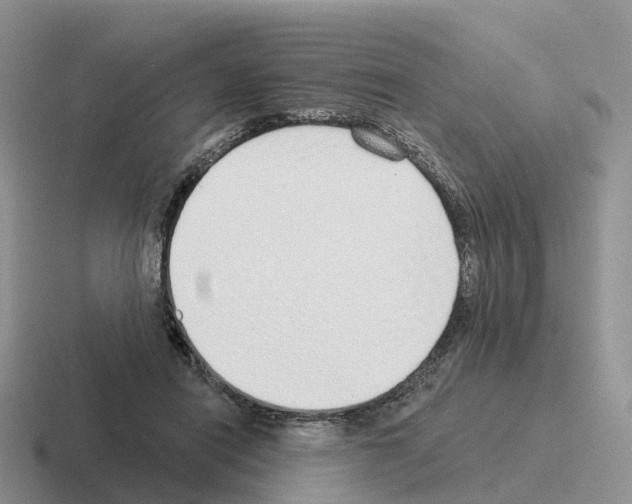 X0000116110454201001041015