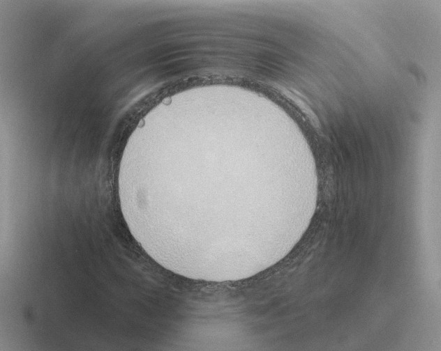 X0000116111015201001041007