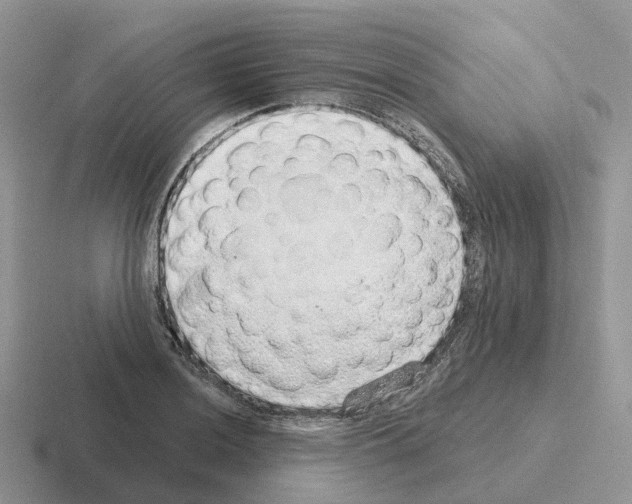 X0000116111036201001041007
