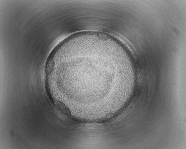 X0000116111077201001041006