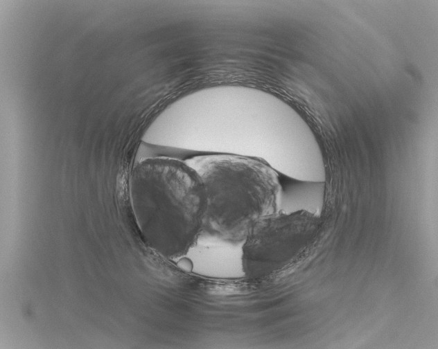 X0000116120177200911230938