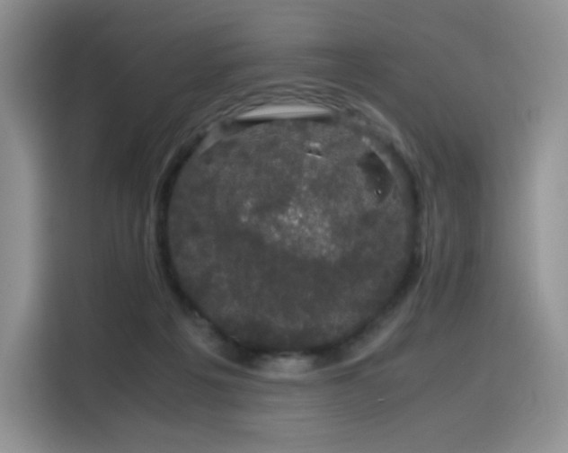 X0000116120217200911231222