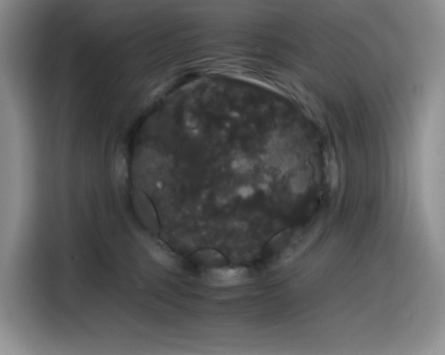 X0000116120375200911231220