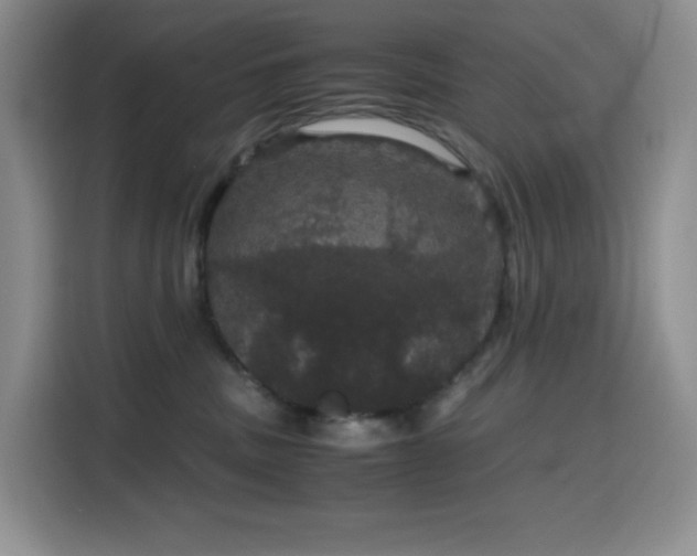 X0000116120379200911231220