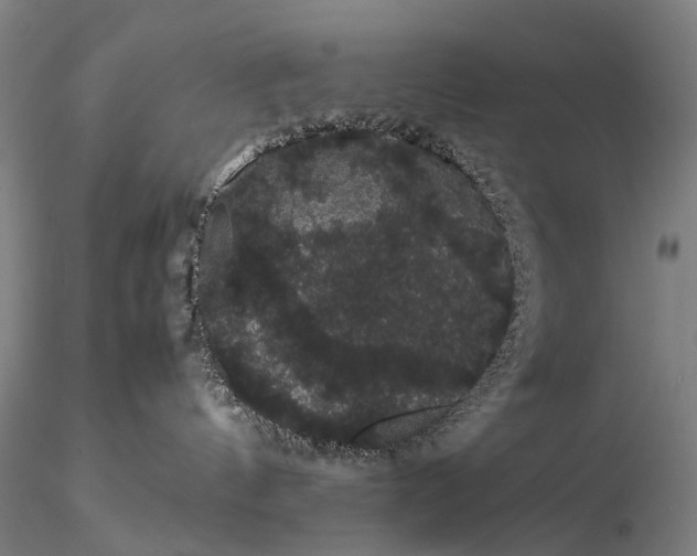 X0000116120144200912071355