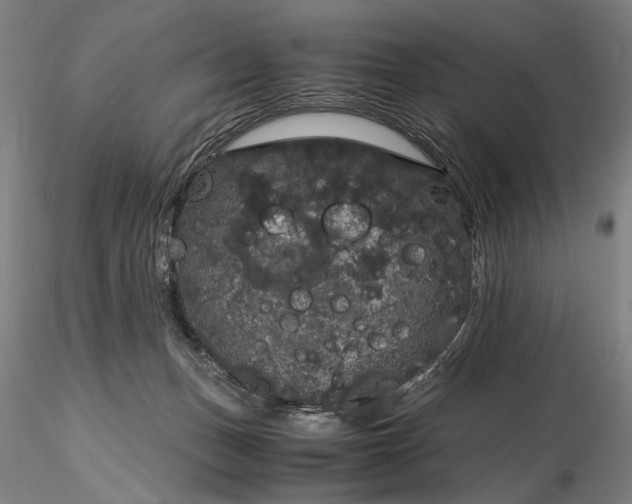 X0000116120175200912071354