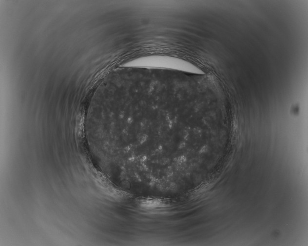 X0000116120177200912071354