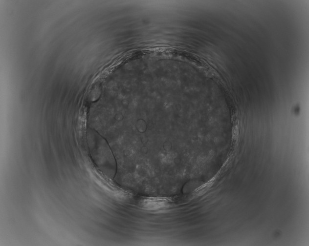 X0000116120179200912071354