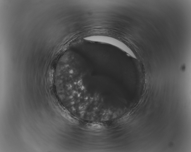 X0000116120475200912071350