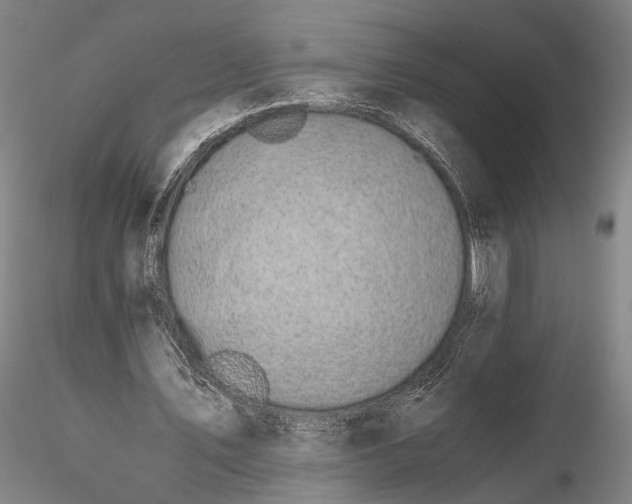 X0000116120579200912071348