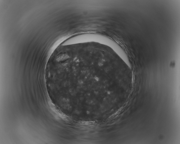 X0000116120147200912141053